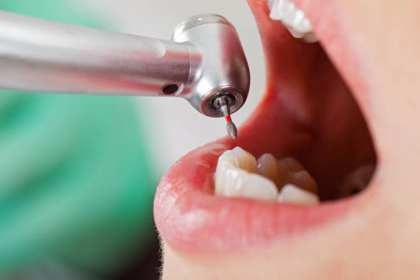 Best Pediatric Emergency Dentist in Huntley, IL